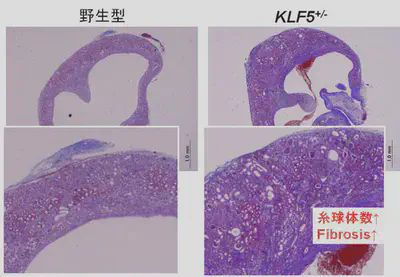 __KLF5欠損による腎組織障害抑制__