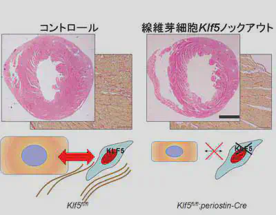 __線維芽細胞Klf5欠損は心肥大を抑制する__