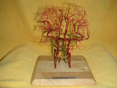 頭部血管模型の作成