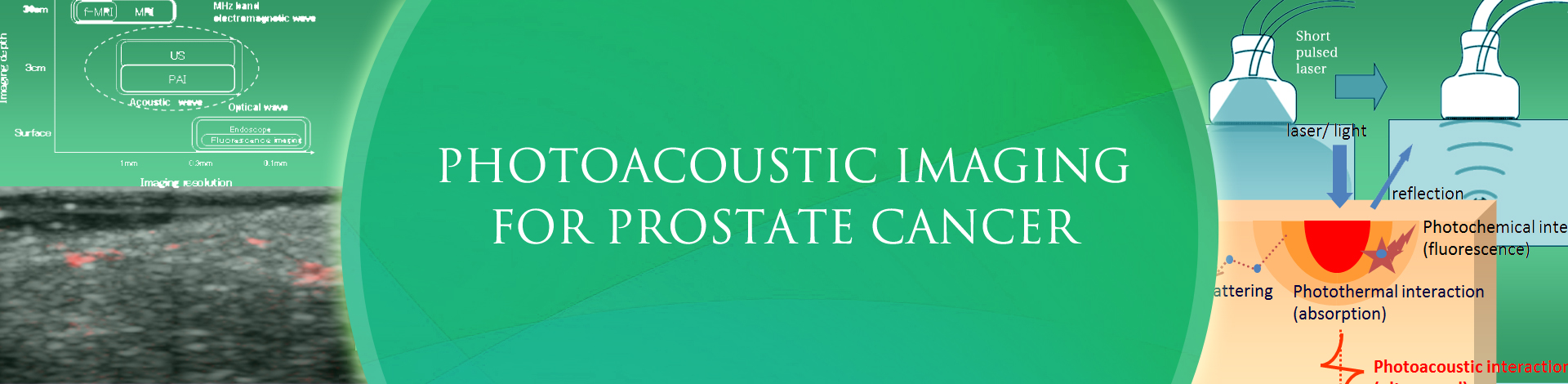PHOTOACOUSTIC IMAGING FOR PROSTATE CANCER