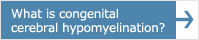 What is congenital cerebral hypomyelination?