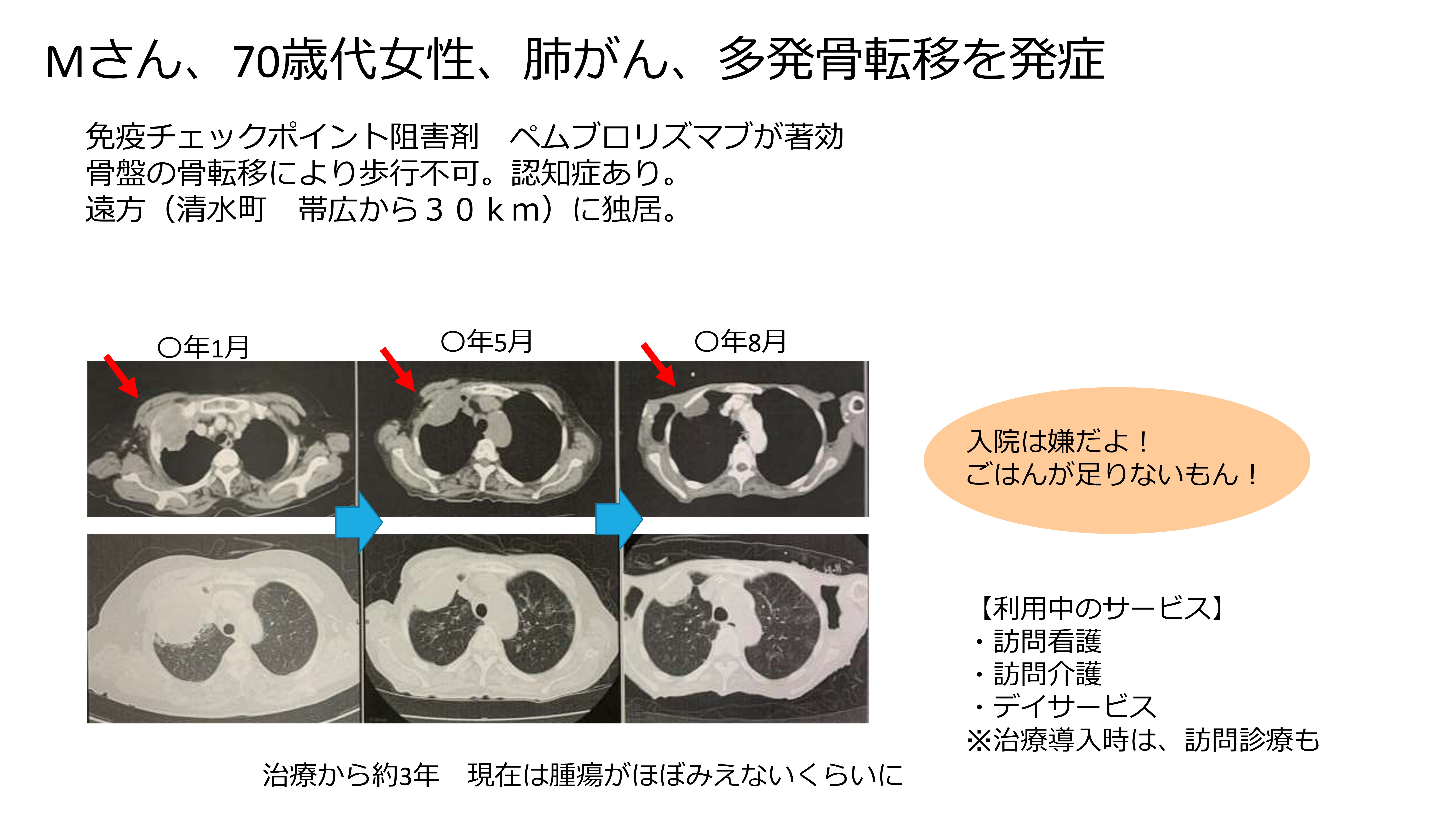 講演の画面05