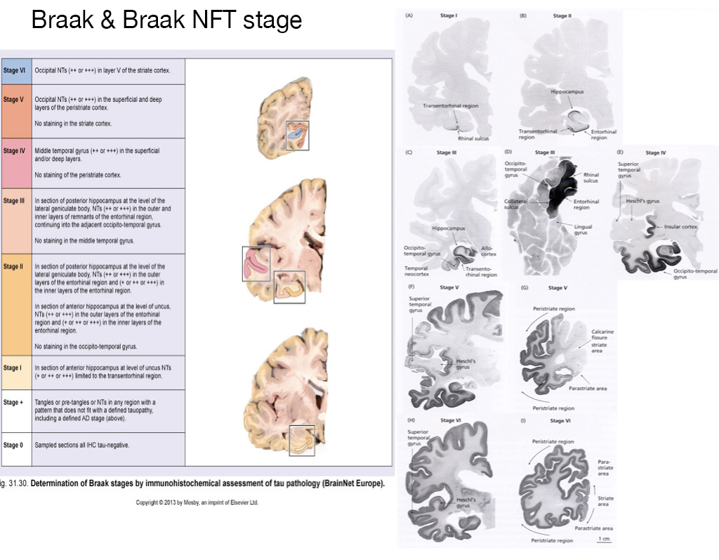 Braak & Braak NFT stage