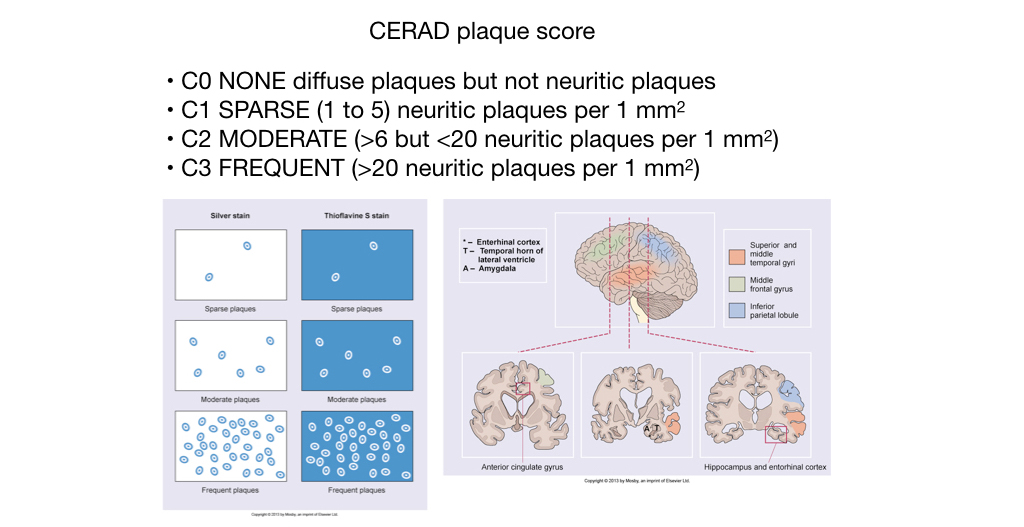 CERAD plaque score