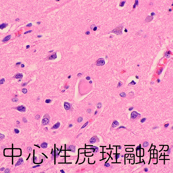 central chromatolysis