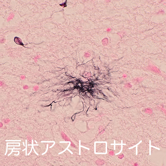 tufted astrocytes