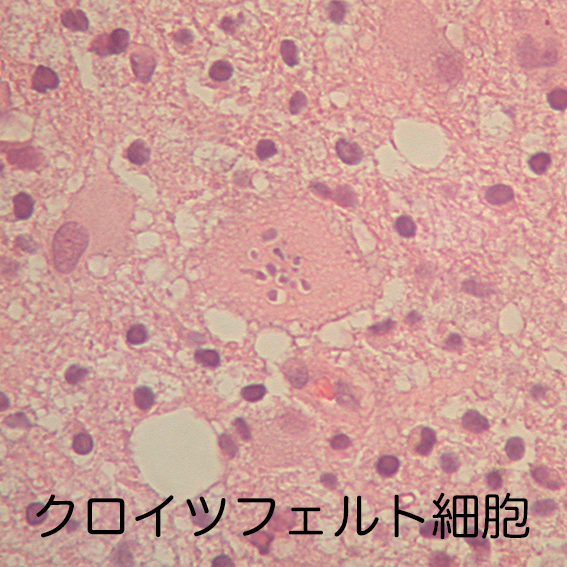 Creutzfeldt cells