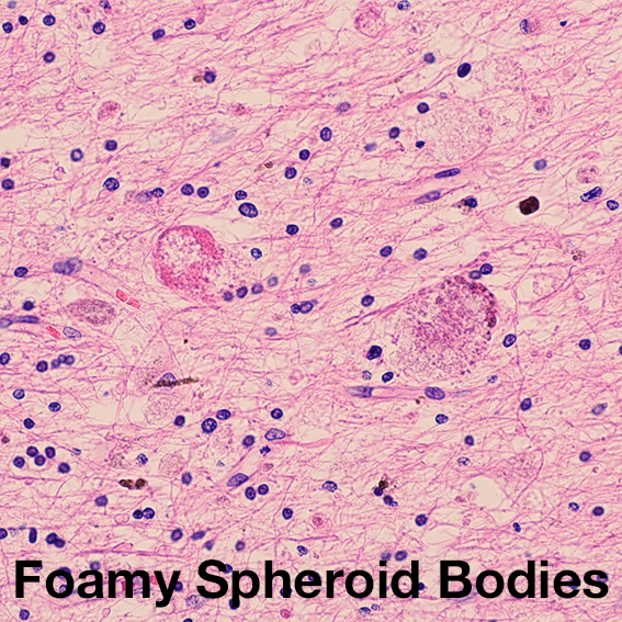 Foamy spheroid bodies