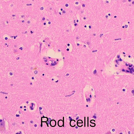 rod cells in progressive paresis