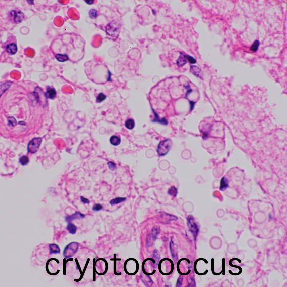 cryptococcus