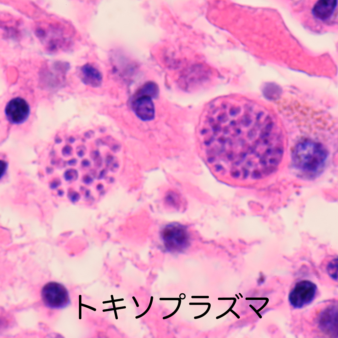 toxoplasma