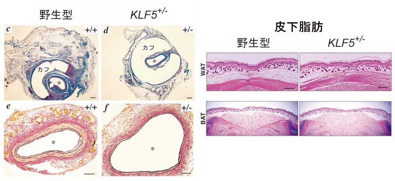 __血管と脂肪組織のKLF5__