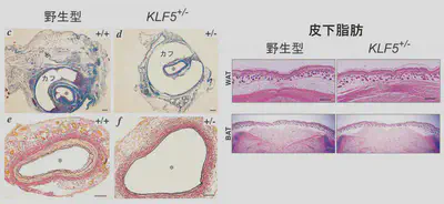 __血管と脂肪組織のKLF5__