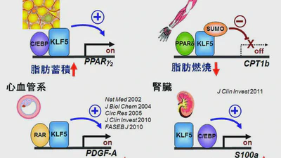 これまでの研究成果(KLF5) featured image