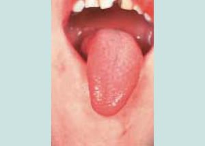 巻き 舌 遺伝