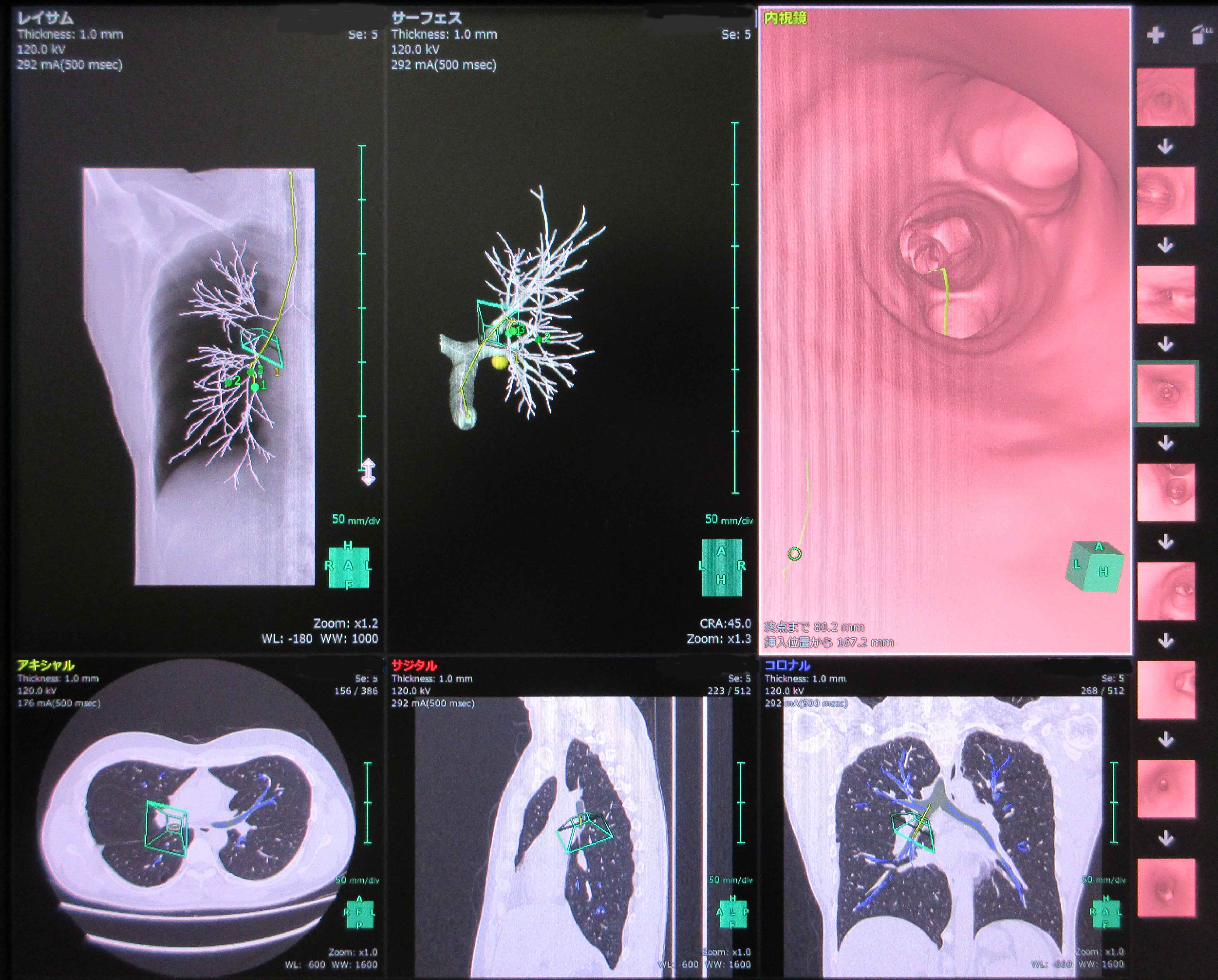 リスクと合併症