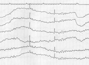 EEG4