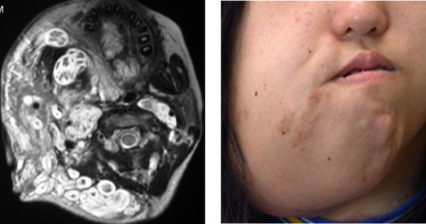 どのように診断されるのでしょうか?