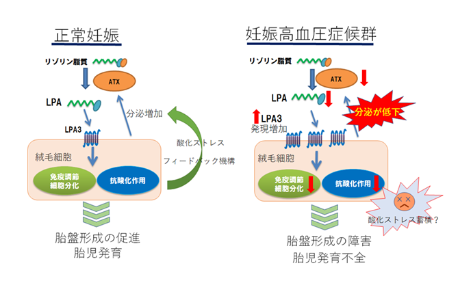 ATX-LPA-LPAR3システムの障害と妊娠高血圧症候群発症の関係