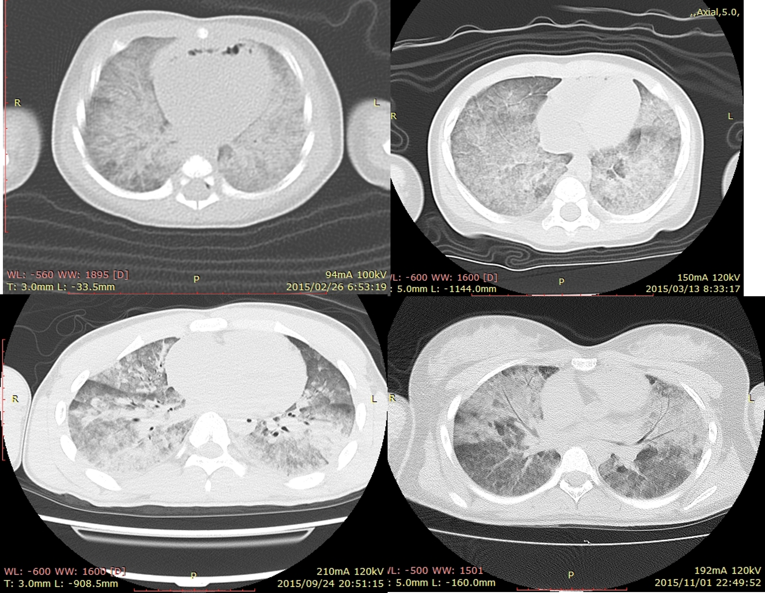 オートプシー・イメージング : 画像解剖 - 健康・医学