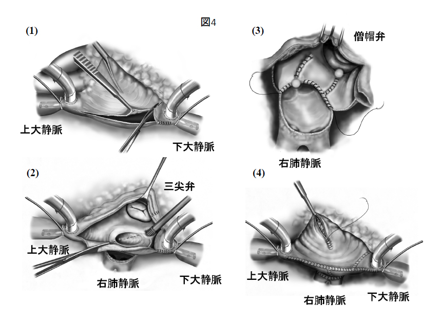迷路手順の成功率