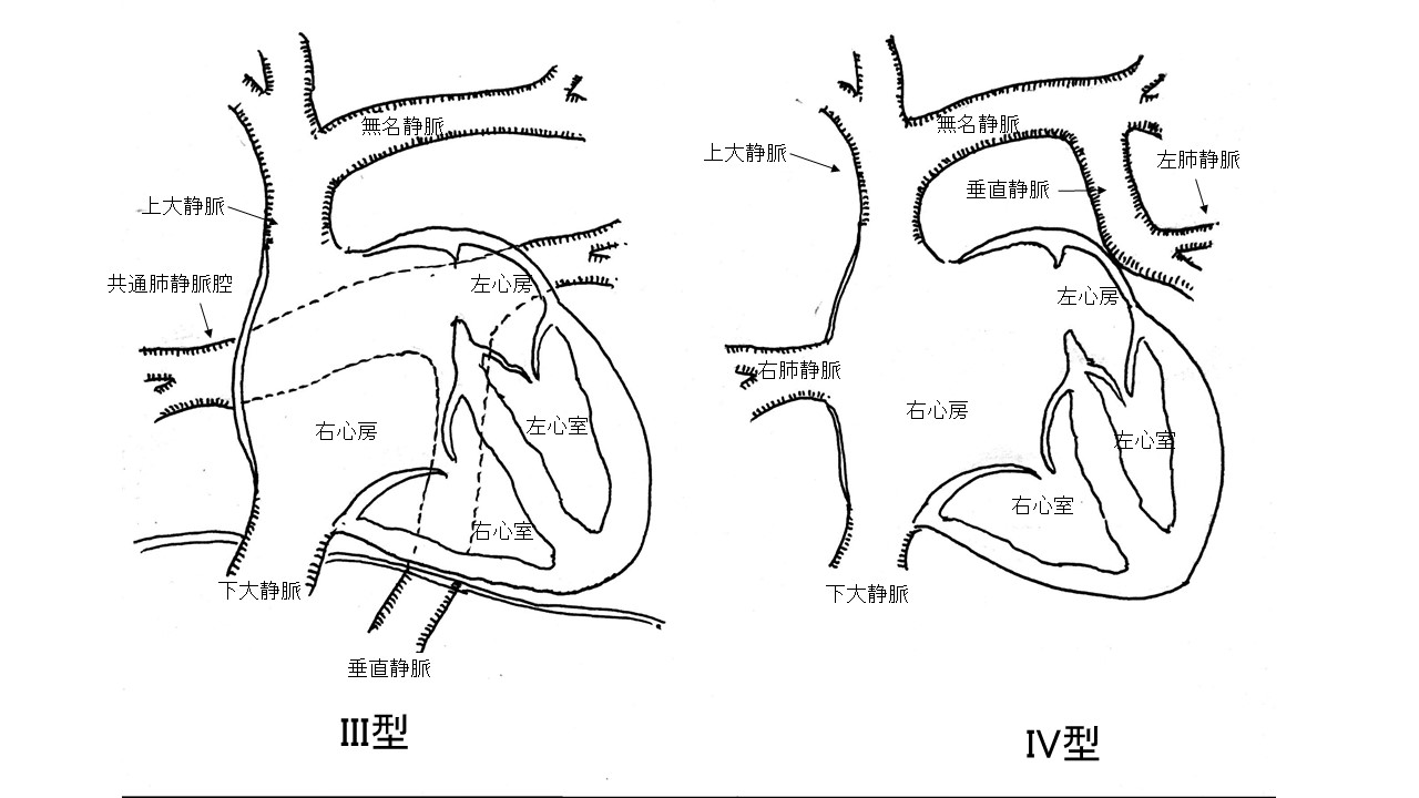 図2:心臓型