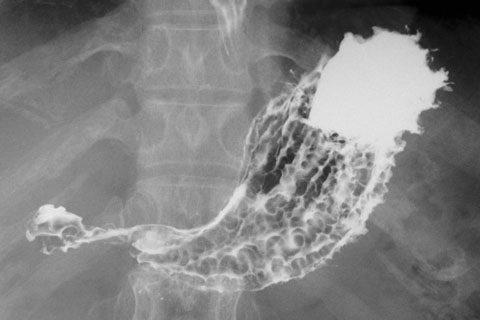 どのように機能するのでしょうか?
